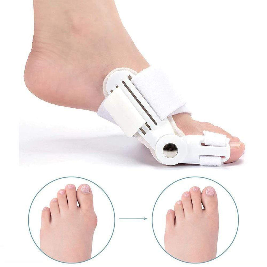 OrthoCorrect Zehenstütze: Korrigierende Hallux Valgus Lösung
