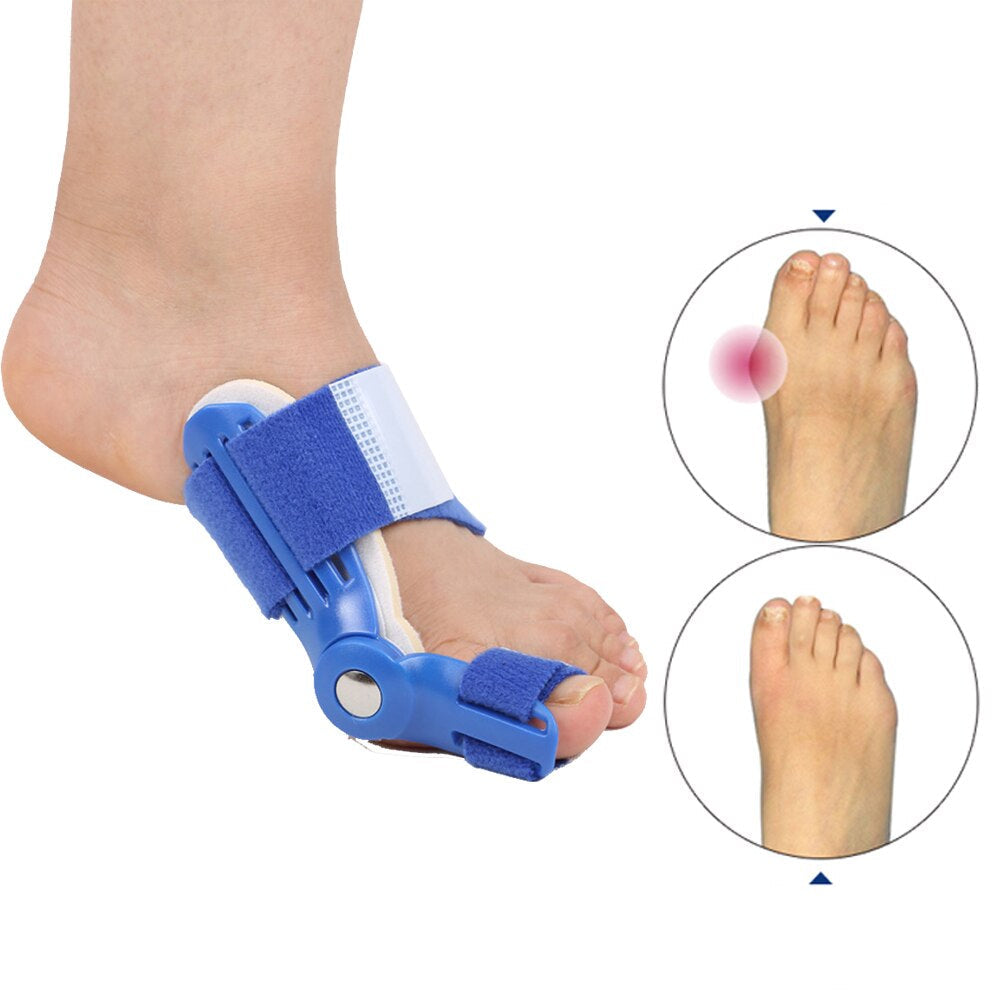 OrthoCorrect Zehenstütze: Korrigierende Hallux Valgus Lösung