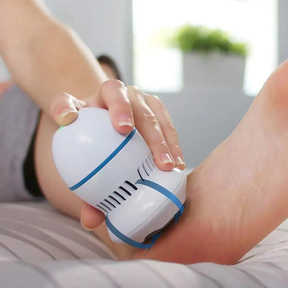 SoftFeet – Hornhautentferner