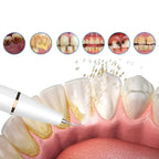 FreshSmile Ultraschall-Zahnbürste – Für Saubere sowie Gesunde Zähne
