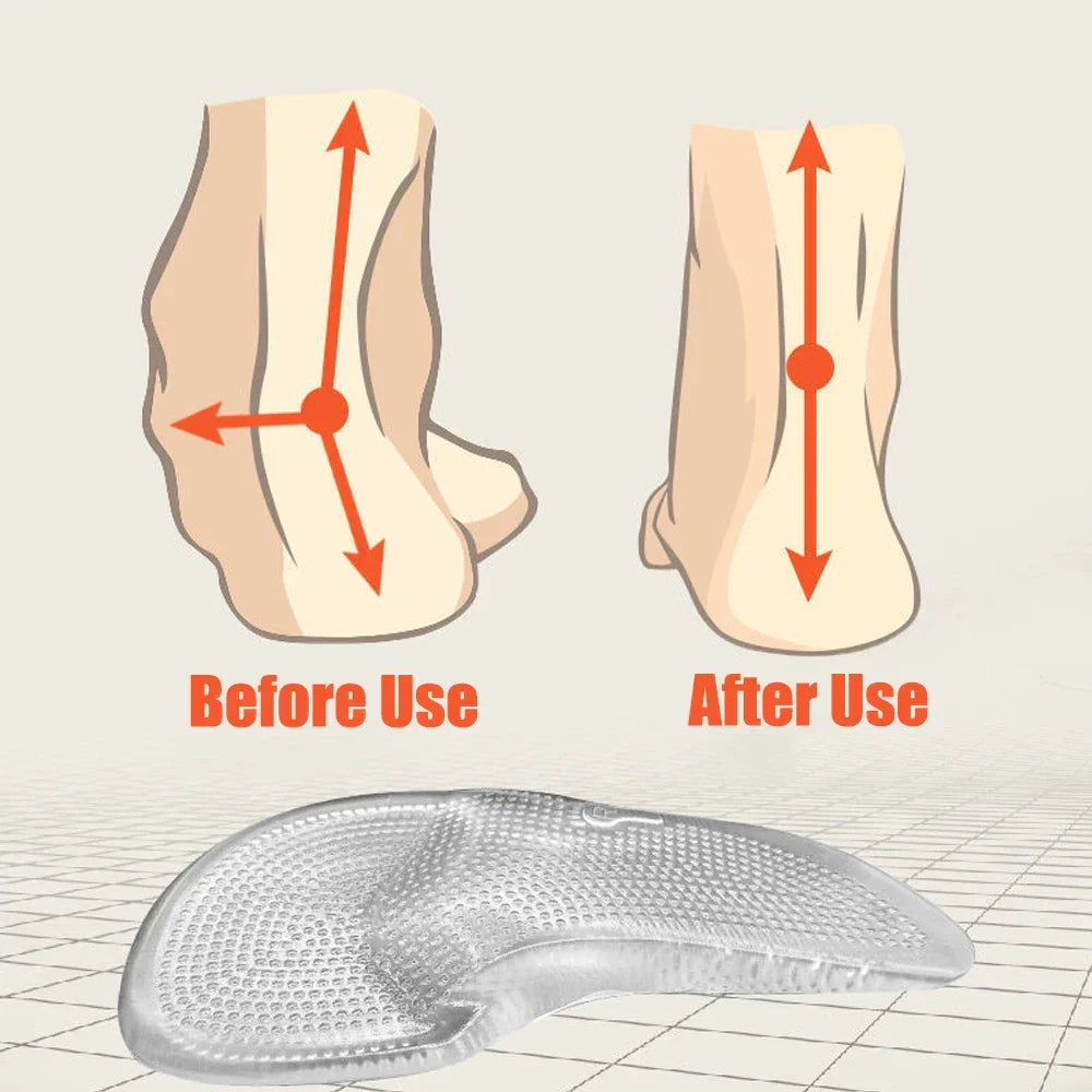 Silicone-Gel-Orthopädische Einlagen: Fußgewölbeunterstützung & Komfort