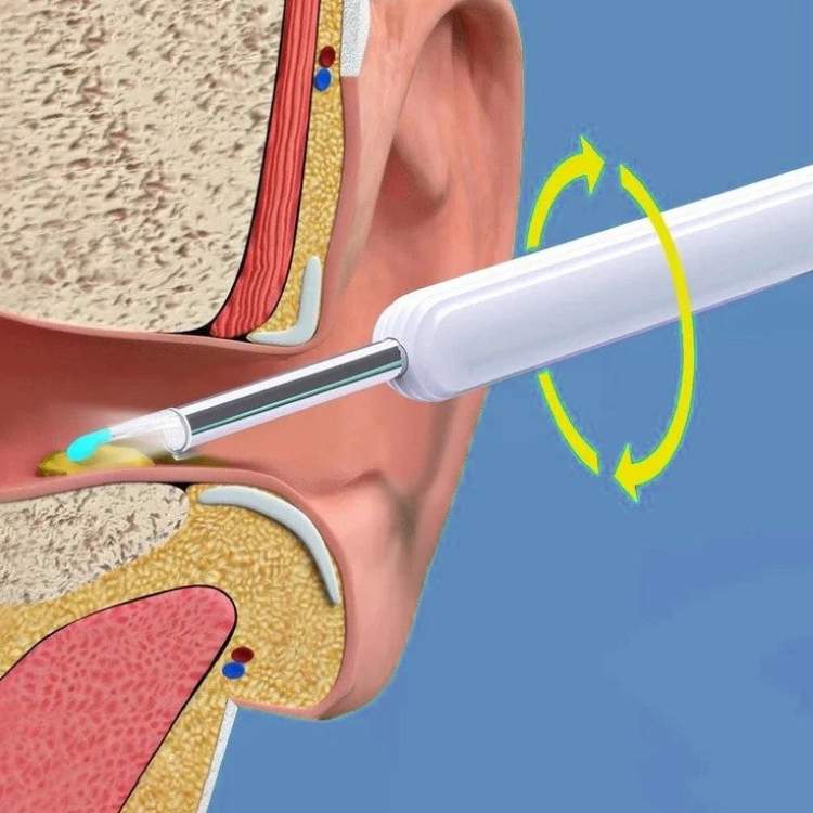 ClearView Ohrreiniger – Schlank, Sicher sowie Hygienisch
